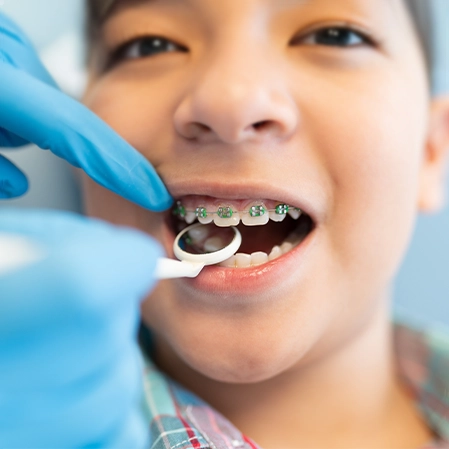 Child With Braces Receiving An Exam