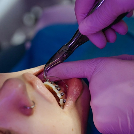 Patient Having Work Done On Their Braces